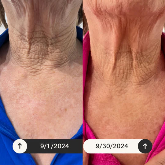 The Neck Lift Intensive Firming Cream